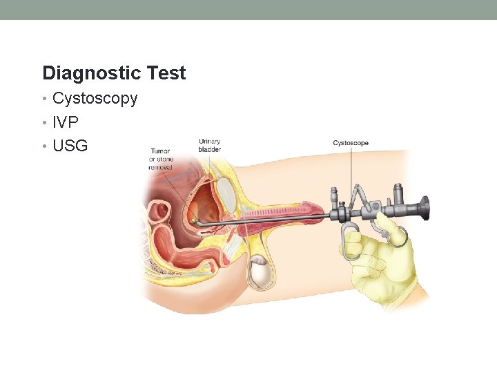 Diagnostic Test • Cystoscopy • IVP • USG 