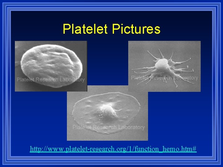 Platelet Pictures http: //www. platelet-research. org/1/function_hemo. htm# 