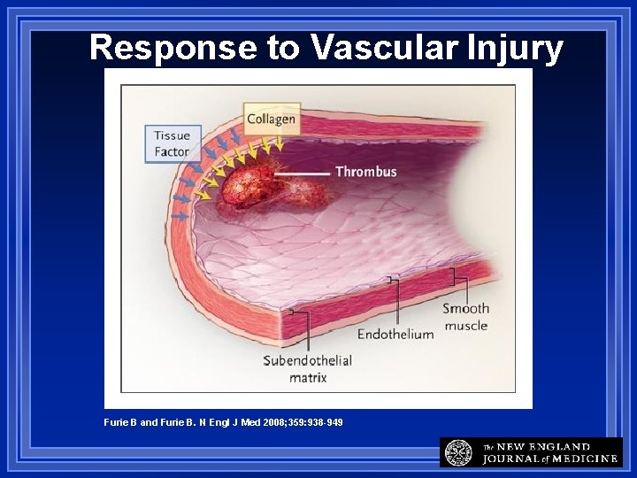 Response to Vascular Injury Furie B and Furie B. N Engl J Med 2008;