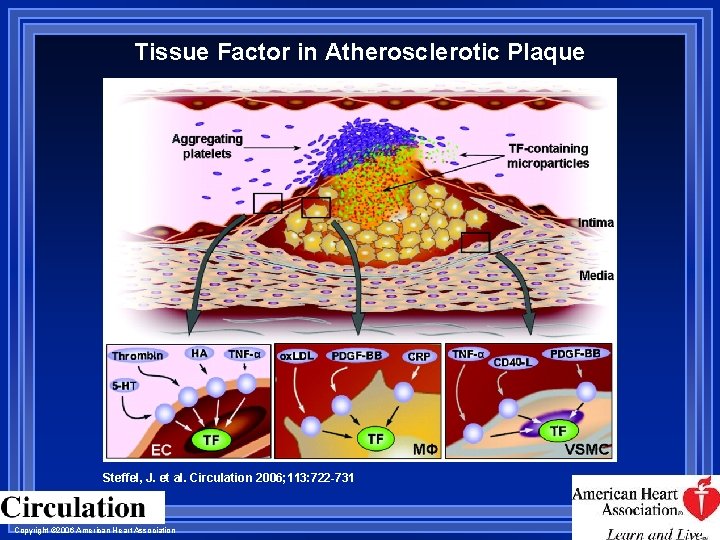 Tissue Factor in Atherosclerotic Plaque Steffel, J. et al. Circulation 2006; 113: 722 -731