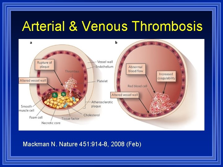 Arterial & Venous Thrombosis Mackman N. Nature 451: 914 -8, 2008 (Feb) 