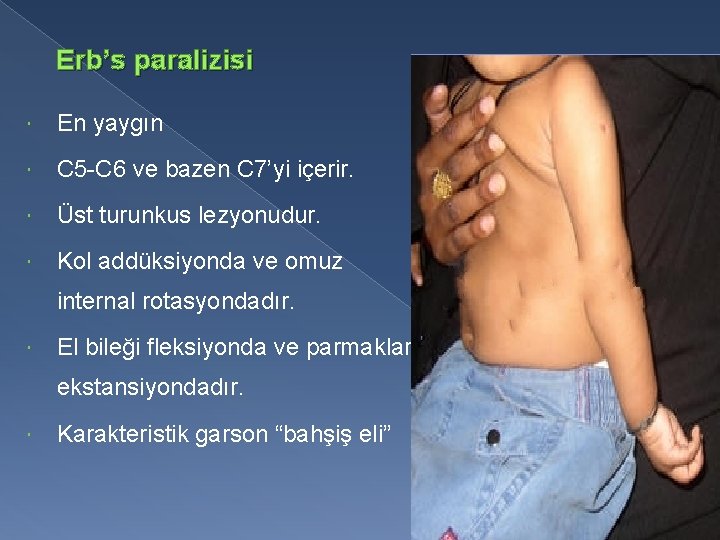 Erb’s paralizisi En yaygın C 5 -C 6 ve bazen C 7’yi içerir. Üst