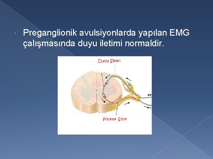  Preganglionik avulsiyonlarda yapılan EMG çalışmasında duyu iletimi normaldir. 