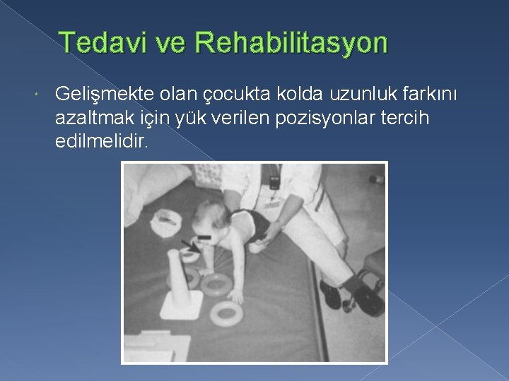 Tedavi ve Rehabilitasyon Gelişmekte olan çocukta kolda uzunluk farkını azaltmak için yük verilen pozisyonlar