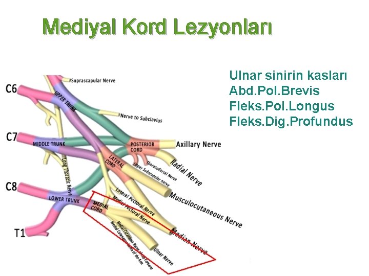 Mediyal Kord Lezyonları Ulnar sinirin kasları Abd. Pol. Brevis Fleks. Pol. Longus Fleks. Dig.