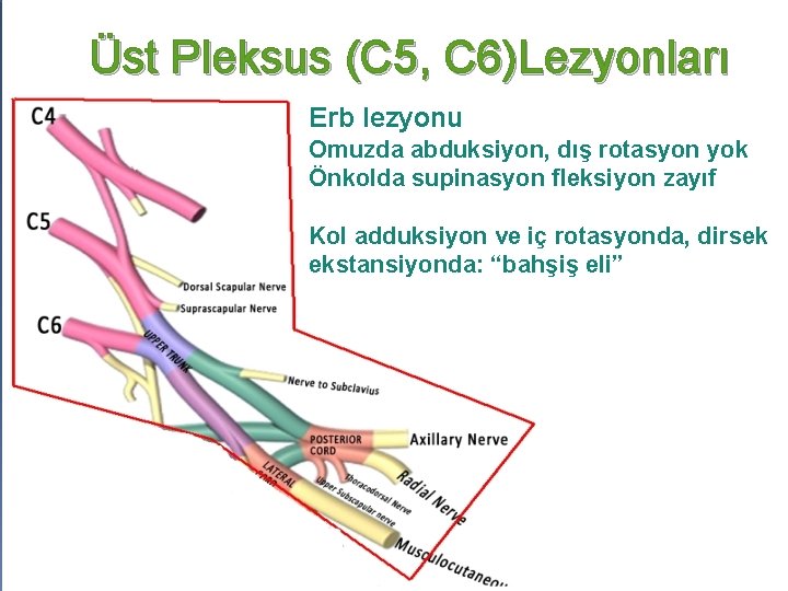 Üst Pleksus (C 5, C 6)Lezyonları Erb lezyonu Omuzda abduksiyon, dış rotasyon yok Önkolda