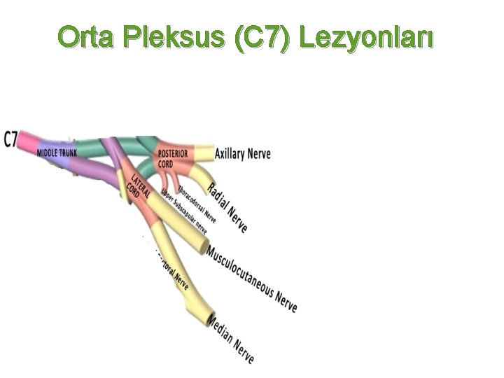 Orta Pleksus (C 7) Lezyonları 