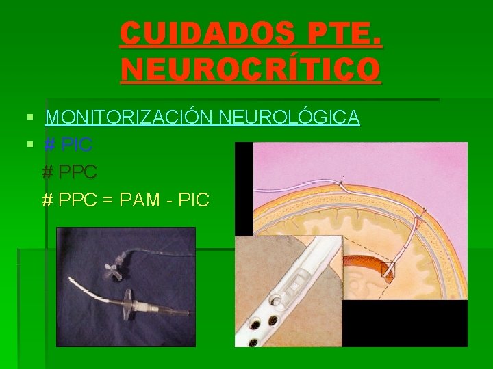 CUIDADOS PTE. NEUROCRÍTICO § MONITORIZACIÓN NEUROLÓGICA § # PIC # PPC = PAM -