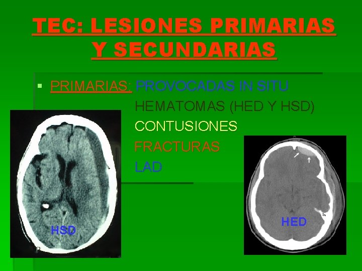 TEC: LESIONES PRIMARIAS Y SECUNDARIAS § PRIMARIAS: PROVOCADAS IN SITU HEMATOMAS (HED Y HSD)