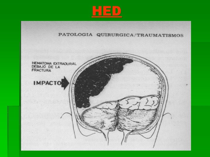HED 