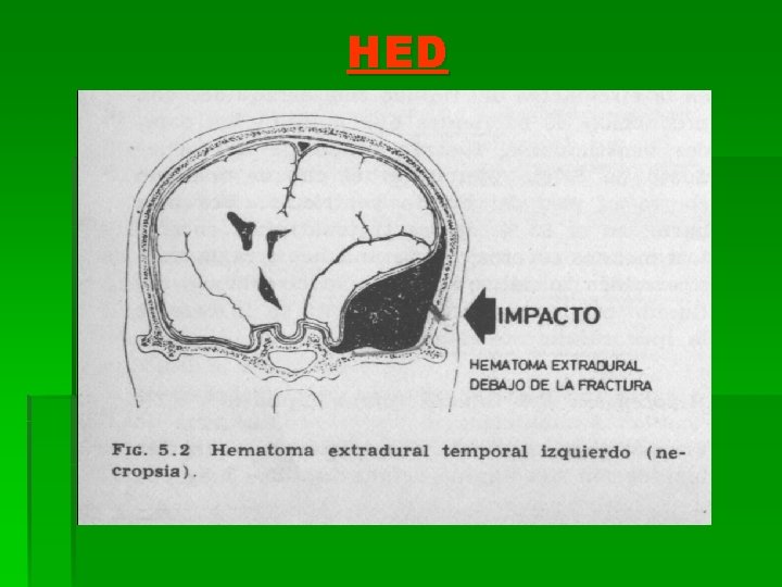 HED 