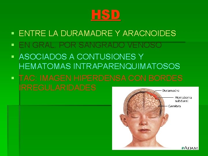 HSD § ENTRE LA DURAMADRE Y ARACNOIDES § EN GRAL. POR SANGRADO VENOSO §