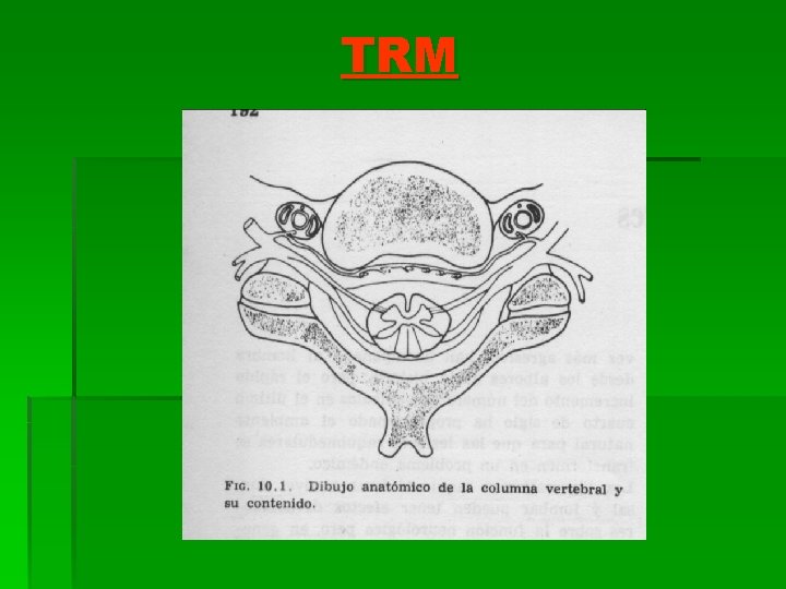 TRM 