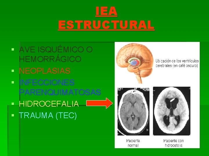 IEA ESTRUCTURAL § AVE ISQUÉMICO O HEMORRÁGICO § NEOPLASIAS § INFECCIONES PARENQUIMATOSAS § HIDROCEFALIA