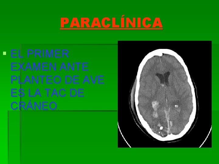 PARACLÍNICA § EL PRIMER EXAMEN ANTE PLANTEO DE AVE ES LA TAC DE CRÁNEO.