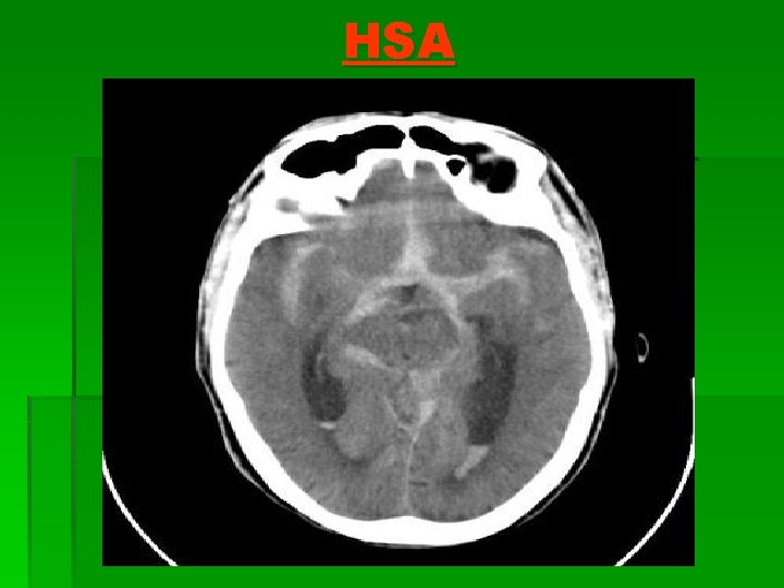 HSA 