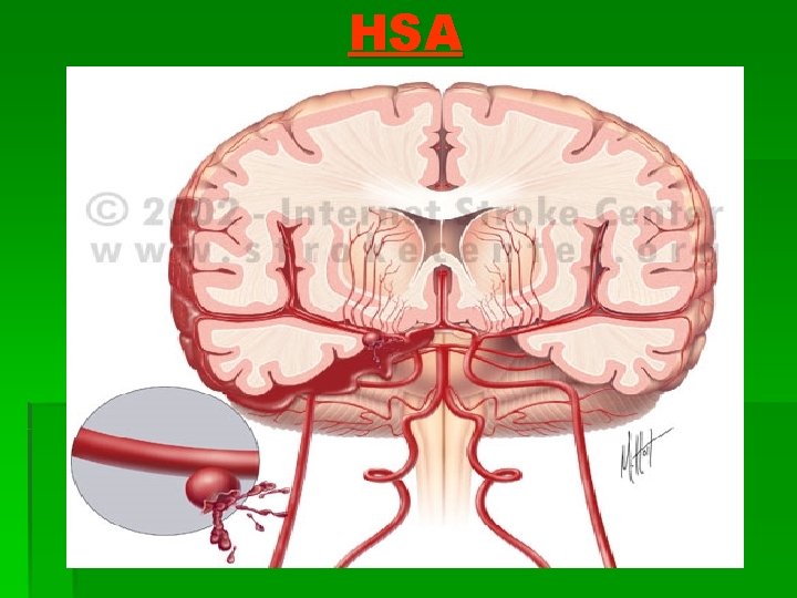 HSA 