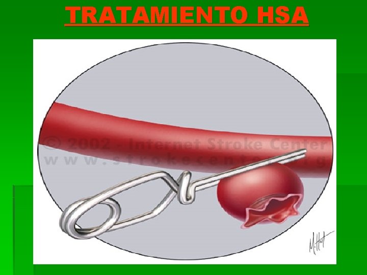TRATAMIENTO HSA 