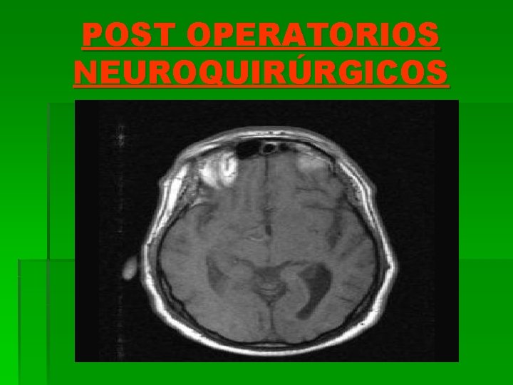 POST OPERATORIOS NEUROQUIRÚRGICOS 