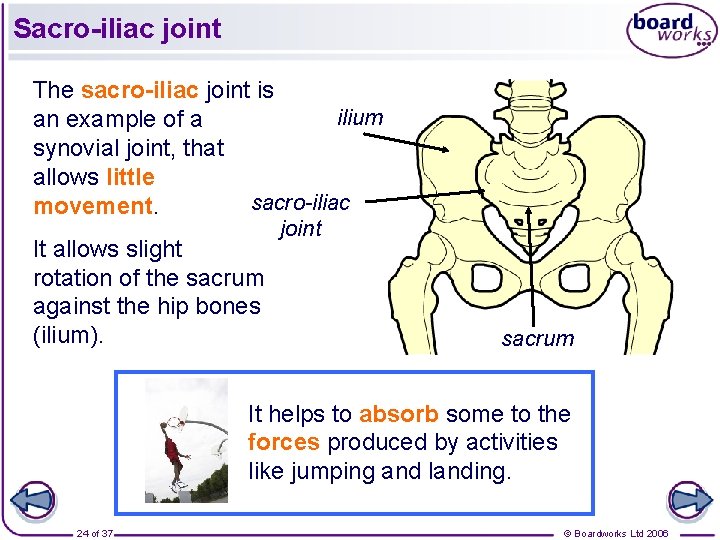 Sacro-iliac joint The sacro-iliac joint is ilium an example of a synovial joint, that