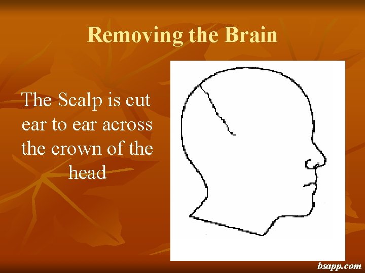 Removing the Brain The Scalp is cut ear to ear across the crown of