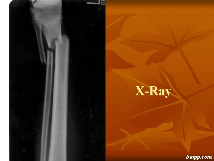 X-Ray bsapp. com 