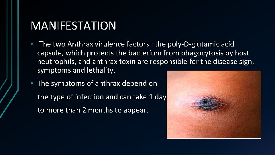 MANIFESTATION • The two Anthrax virulence factors : the poly-D-glutamic acid capsule, which protects