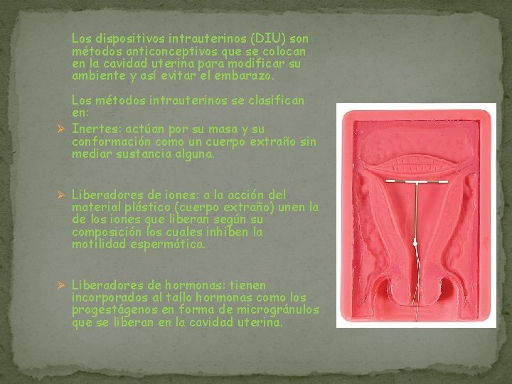 Los dispositivos intrauterinos (DIU) son métodos anticonceptivos que se colocan en la cavidad uterina