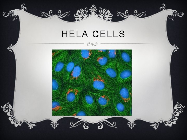 HELA CELLS 