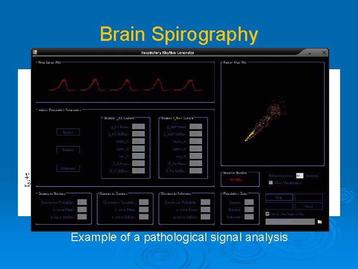 Brain Spirography Example of a pathological signal analysis 