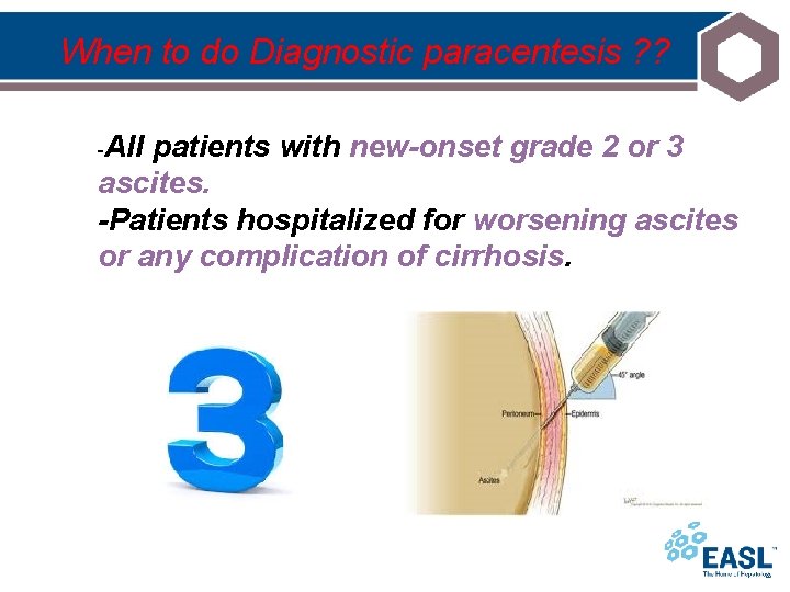 When to do Diagnostic paracentesis ? ? -All patients with new-onset grade 2 or