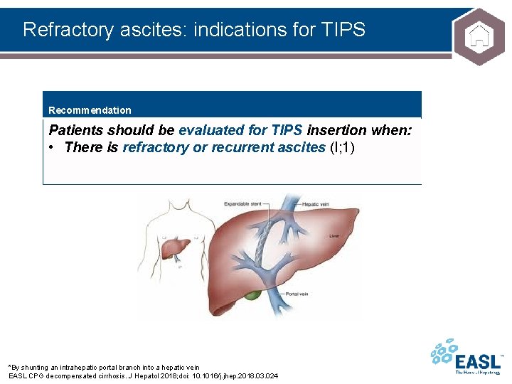 Refractory ascites: indications for TIPS Recommendation Patients should be evaluated for TIPS insertion when: