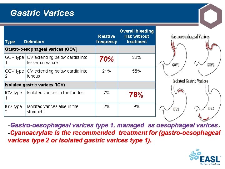 Gastric Varices Type Definition Overall bleeding risk without Relative frequency treatment Gastro-oesophageal varices (GOV)