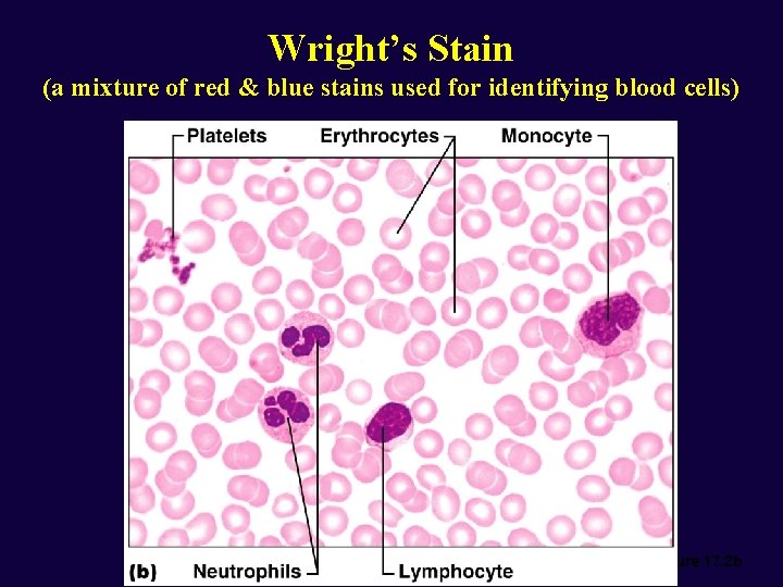 Wright’s Stain (a mixture of red & blue stains used for identifying blood cells)