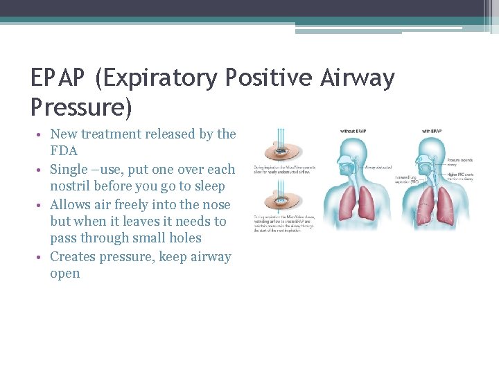 EPAP (Expiratory Positive Airway Pressure) • New treatment released by the FDA • Single