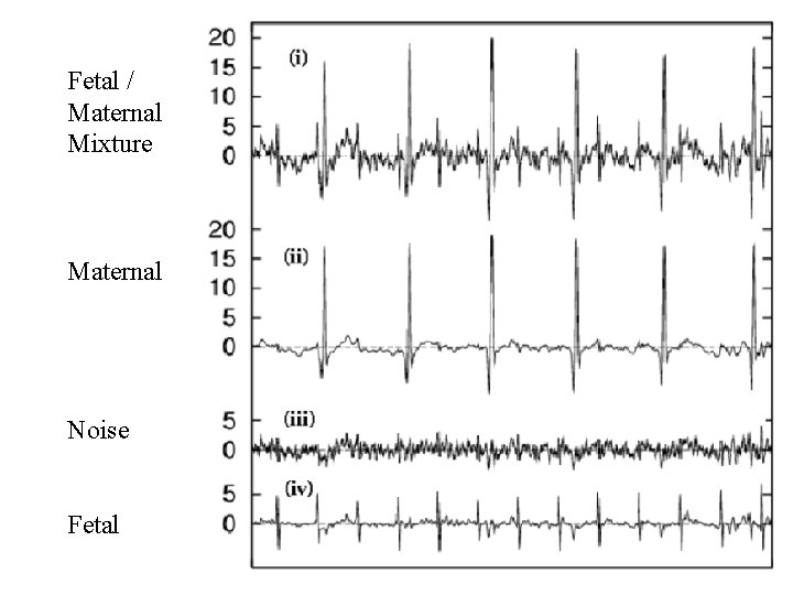 Fetal / Maternal Mixture Maternal Noise Fetal 