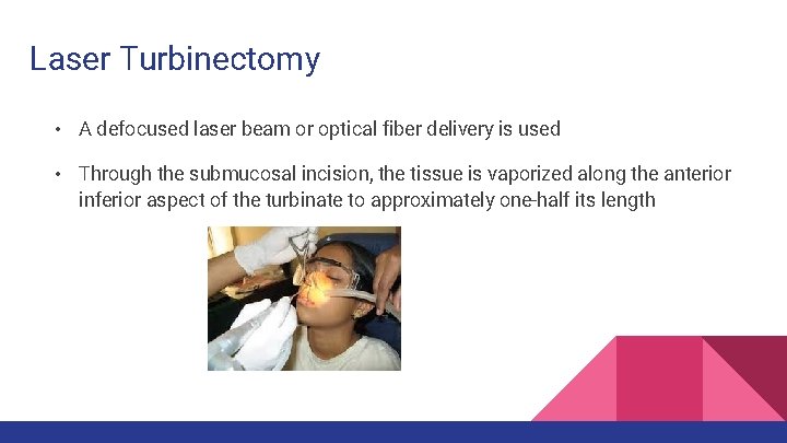 Laser Turbinectomy • A defocused laser beam or optical fiber delivery is used •