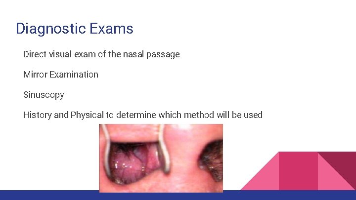 Diagnostic Exams Direct visual exam of the nasal passage Mirror Examination Sinuscopy History and Diagnostic Exams Direct visual exam of the nasal passage Mirror Examination Sinuscopy History and