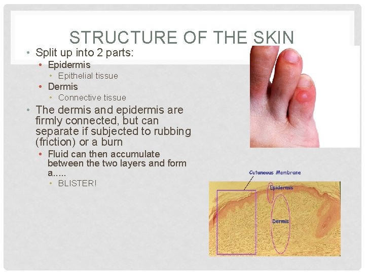 STRUCTURE OF THE SKIN • Split up into 2 parts: • Epidermis • Epithelial