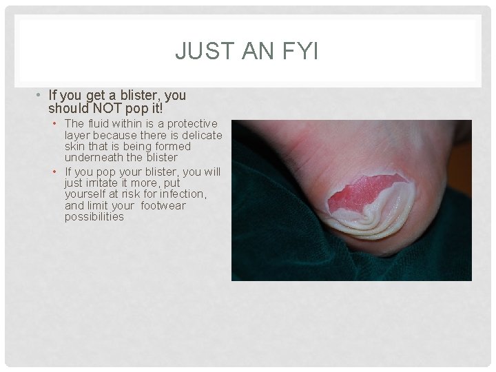 JUST AN FYI • If you get a blister, you should NOT pop it!