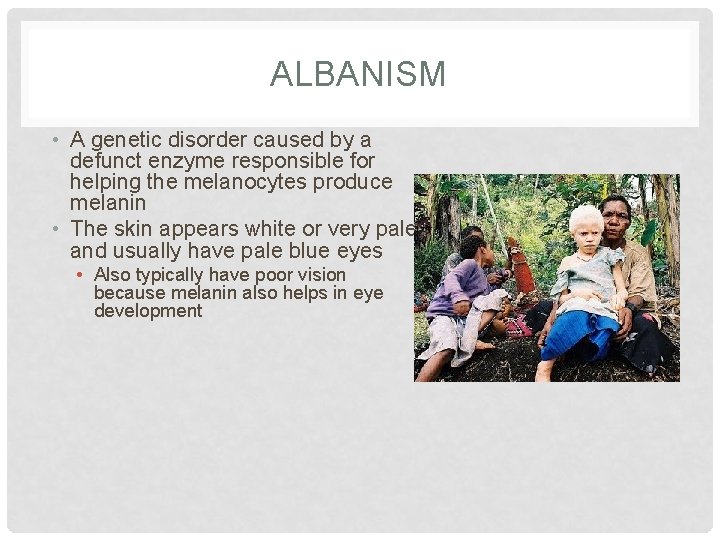 ALBANISM • A genetic disorder caused by a defunct enzyme responsible for helping the