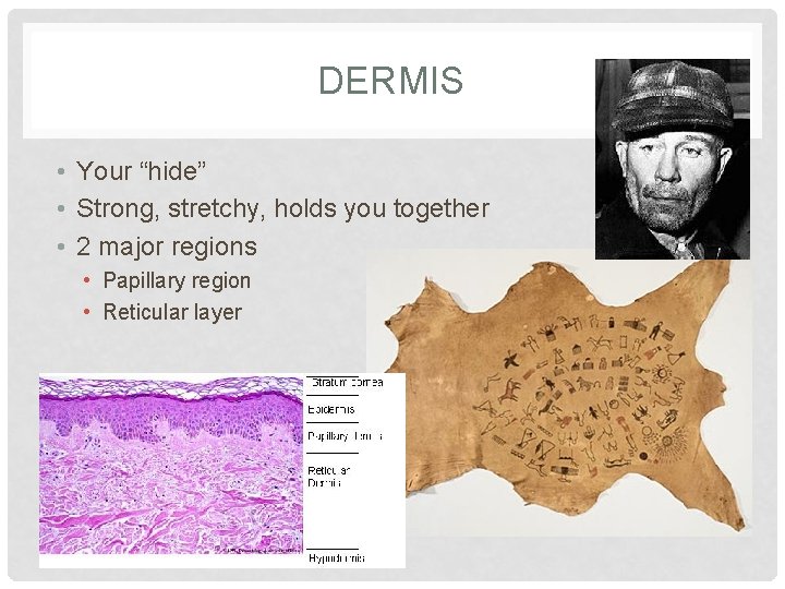 DERMIS • Your “hide” • Strong, stretchy, holds you together • 2 major regions