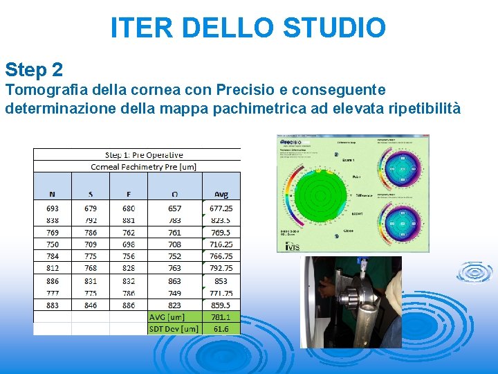 ITER DELLO STUDIO Step 2 Tomografia della cornea con Precisio e conseguente determinazione della