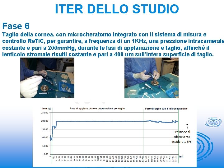 ITER DELLO STUDIO Fase 6 Taglio della cornea, con microcheratomo integrato con il sistema