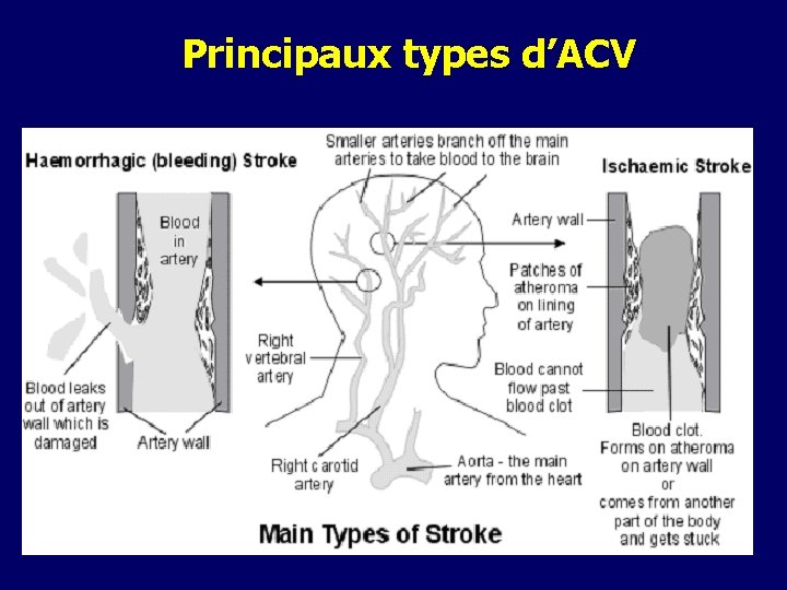 Principaux types d’ACV Principaux types d’ACV