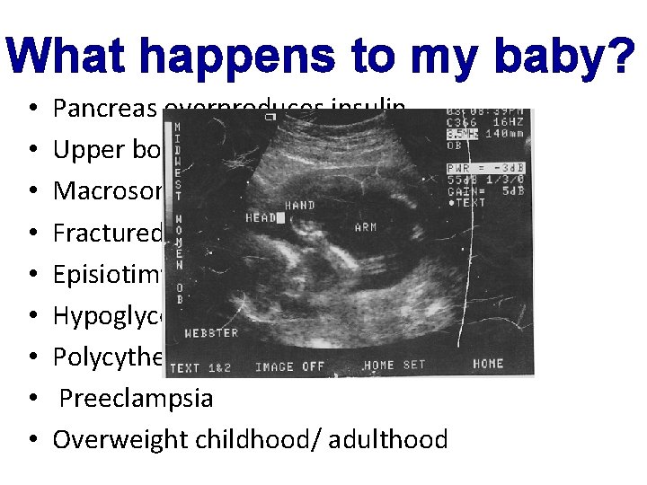 What happens to my baby? • • • Pancreas overproduces insulin Upper body weight