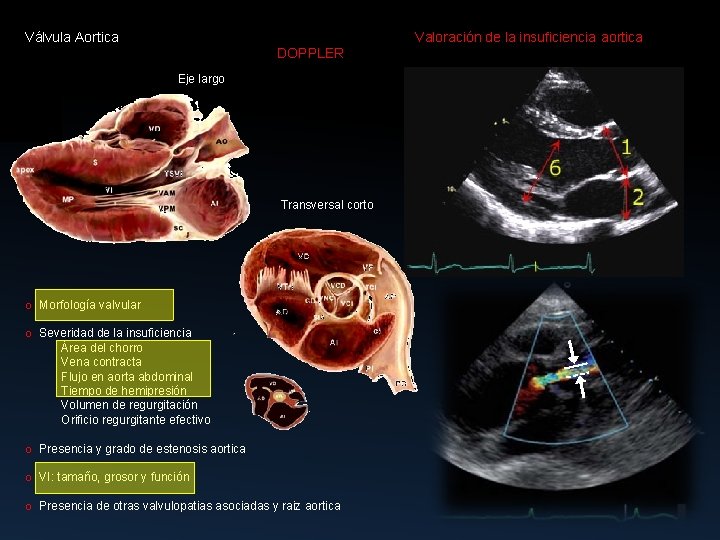 Válvula Aortica Valoración de la insuficiencia aortica DOPPLER Eje largo Transversal corto o Morfología