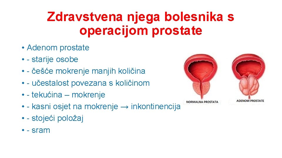 Zdravstvena njega bolesnika s operacijom prostate • Adenom prostate • - starije osobe •