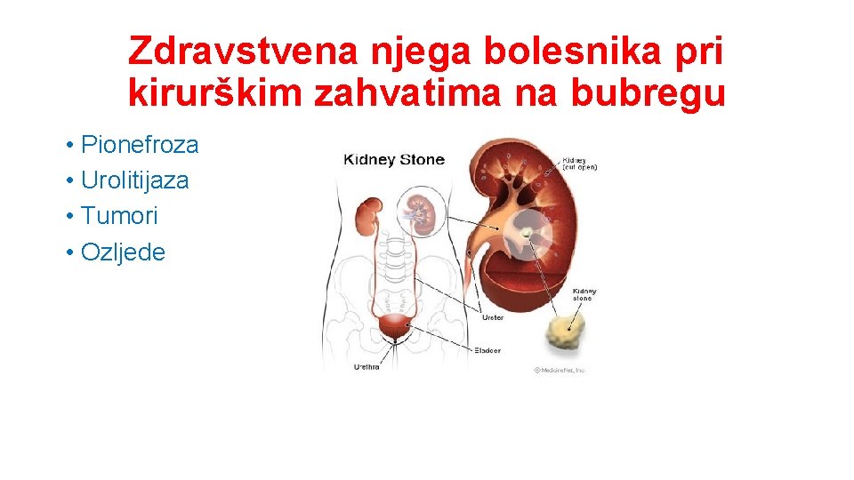 Zdravstvena njega bolesnika pri kirurškim zahvatima na bubregu • Pionefroza • Urolitijaza • Tumori