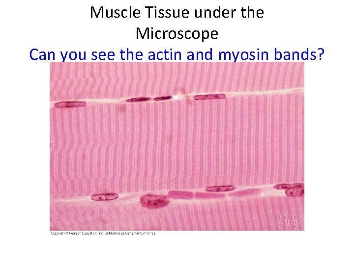 Muscle Tissue under the Microscope Can you see the actin and myosin bands? 